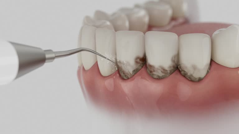 Reliable Tooth Extraction contractor in Oakland, SC by Smile Center Dentistry